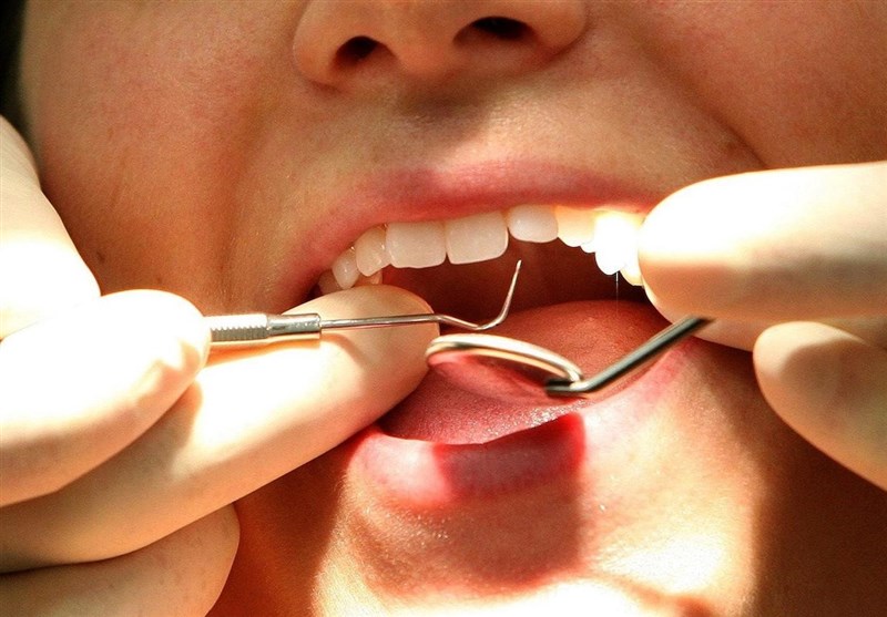 سلامت دهان در ارتباط بین واکسن HPV و سلامت دهان